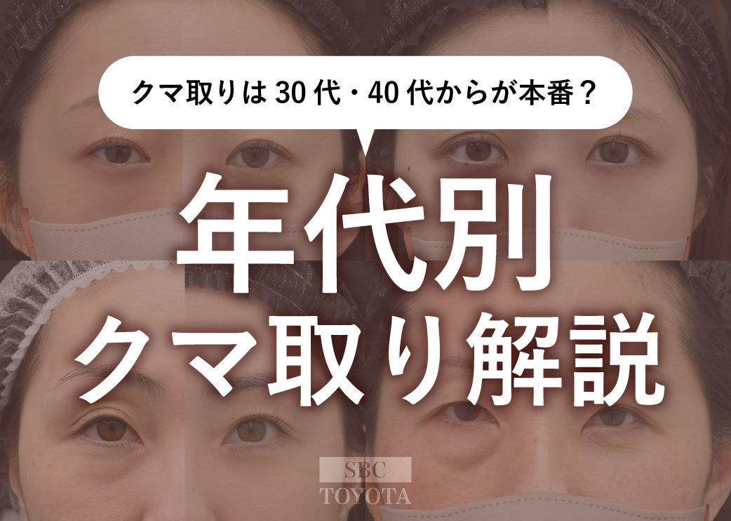 クマ取りは30代・40代からが本番?年代別の解決方法とリアルな症例解説|湘南美容クリニック豊田院
