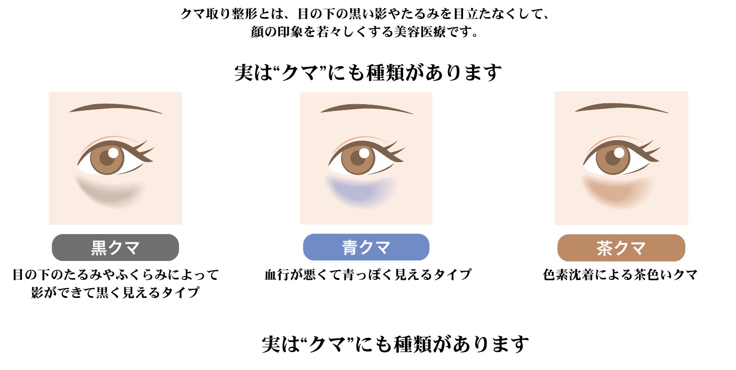 ―「切る」方法も「切らない」方法もある！自分に合った治療を選べる時代