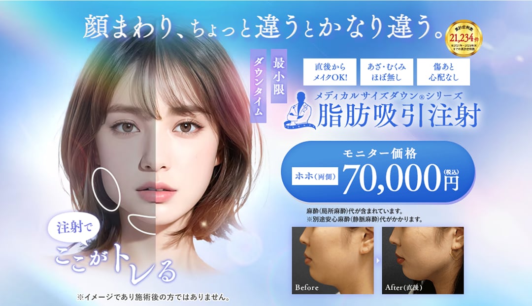 脂肪吸引注射