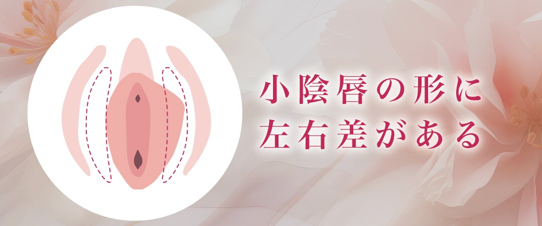小陰唇のカタチが左右で異なる