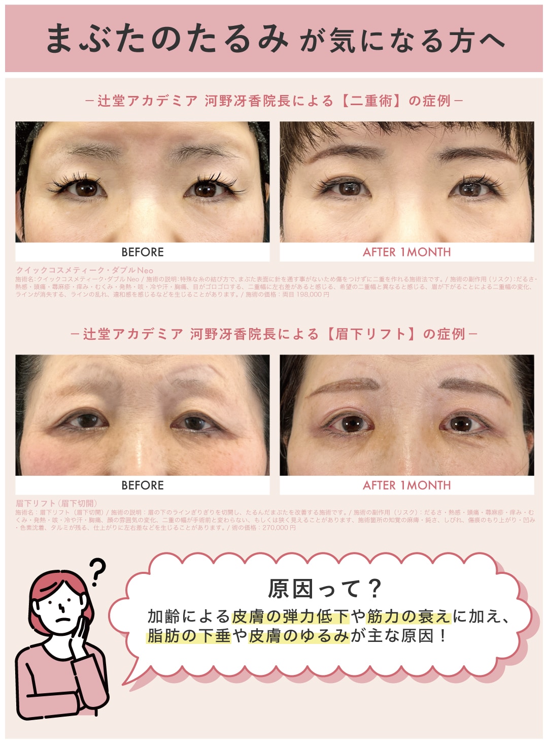 まぶたのたるみの原因