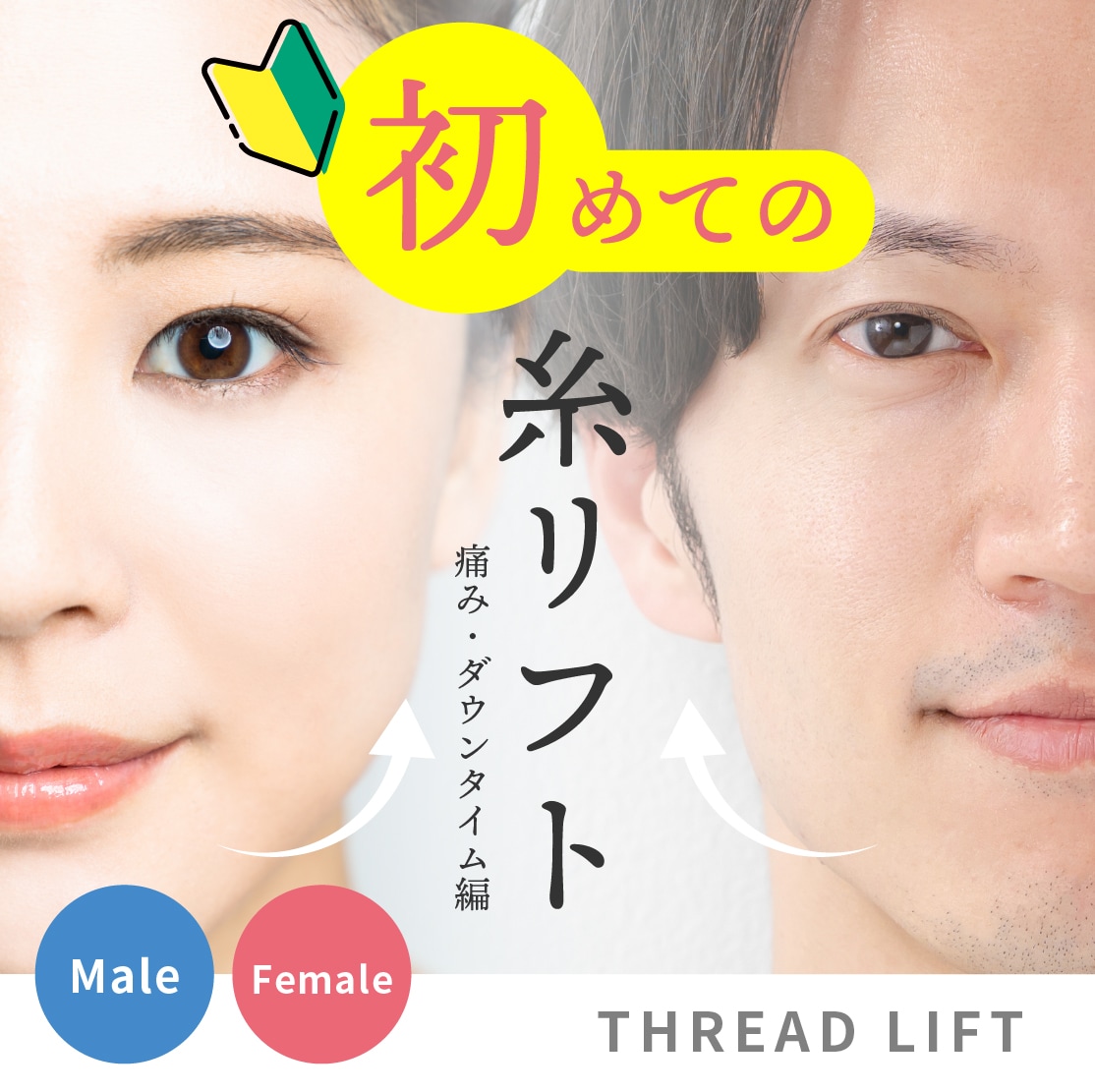 糸リフトは痛い？ダウンタイムが大変？【糸リフト入門ガイド🔰痛み・ダウンタイム編】初めて糸リフトを受けるか悩んでいる方に見て頂きたい湘南美容外科上野院の糸リフト講座