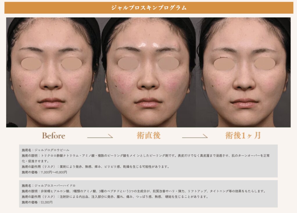 症例写真