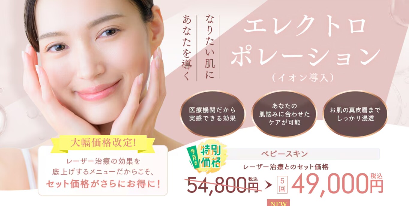 イオン導入