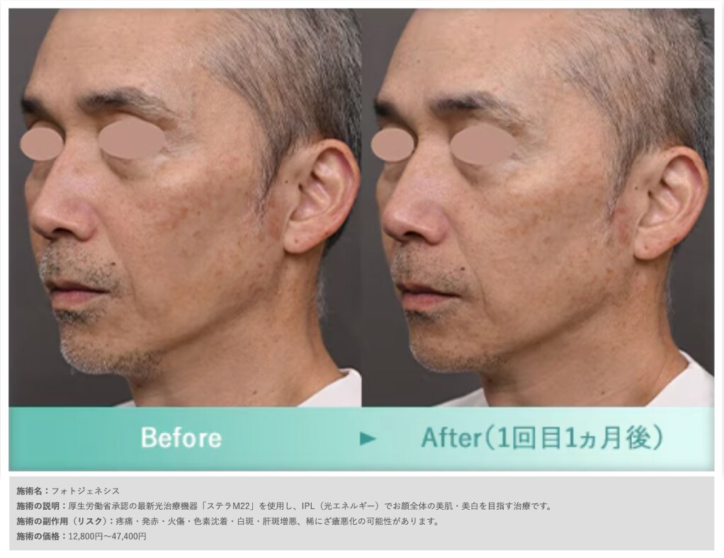 症例写真