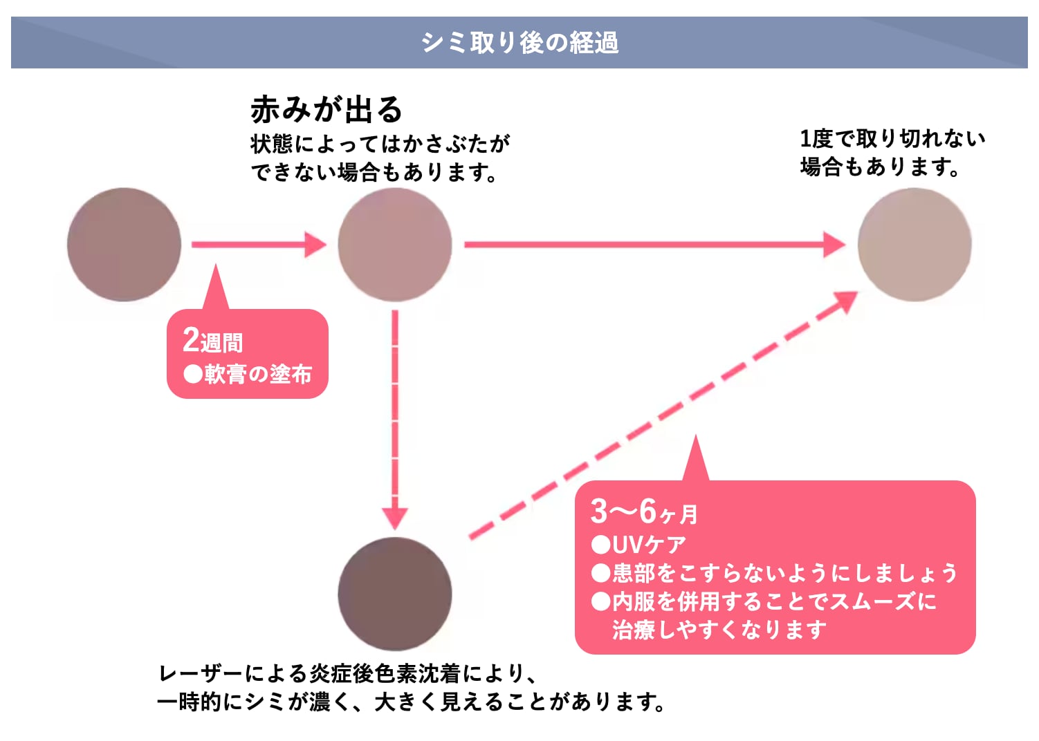 最短3ヶ月でシミを改善