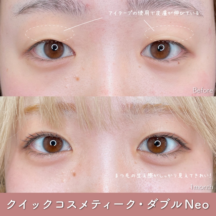 糸留めが表に出ない！デザイン性が高い！強度も強い！！<br />
