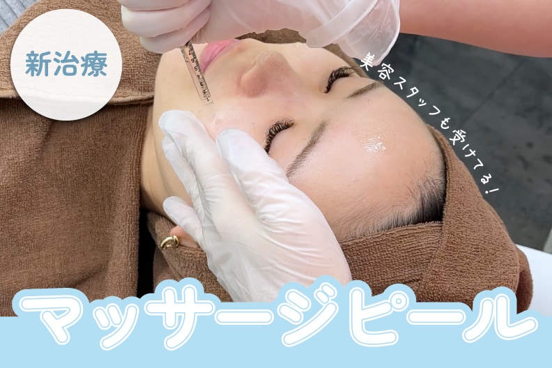 【新治療】宇都宮でできる肌育ピーリング