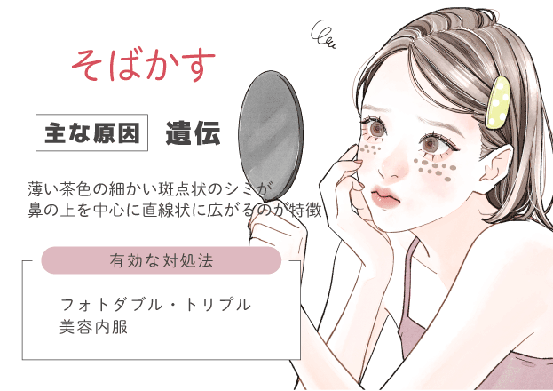 そばかす