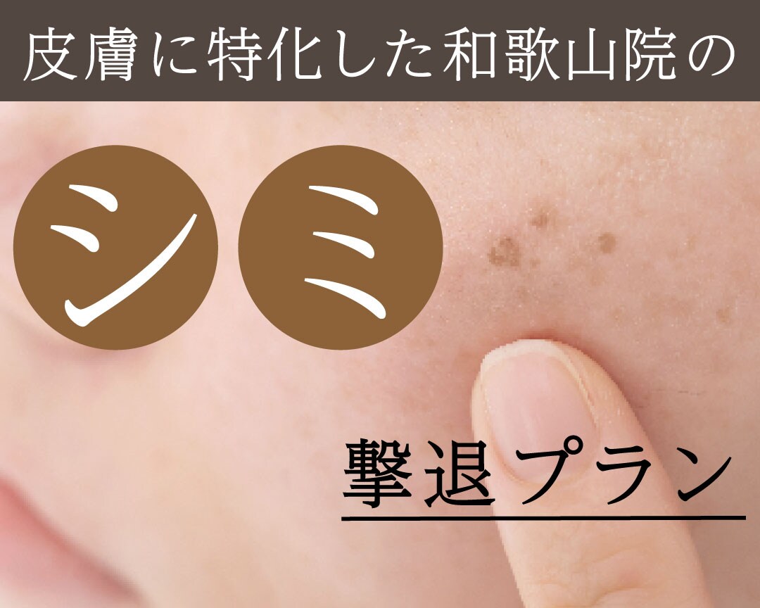 シミ・肝斑を撃退したいあなたに！皮膚に特化したSBC和歌山院がシミ・肝斑撃退法をご紹介☆