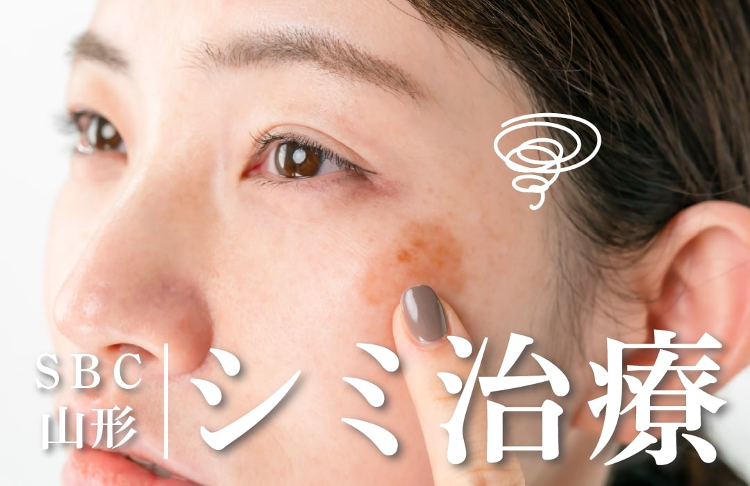 【できてしまったシミは美容医療に限る！】東北・山形でできるシミ治療全部教えちゃいます☆彡