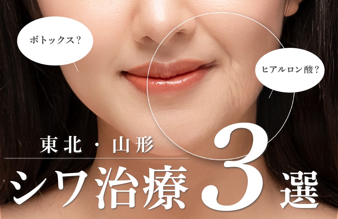 【シワ治療３選】東北・山形で【シワ治療】するなら山形院で！｜湘南美容クリニック山形院