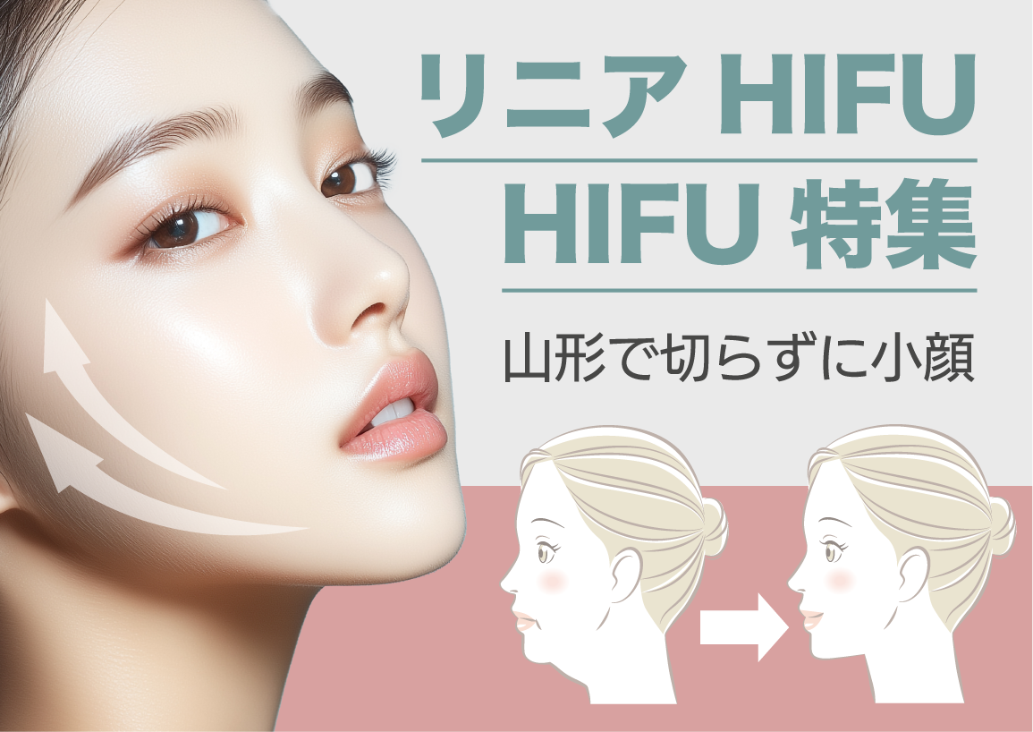 切らずに小顔!湘南美容クリニック山形院のリニアHIFU&HIFU特集