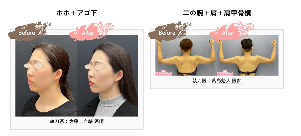 外科CP