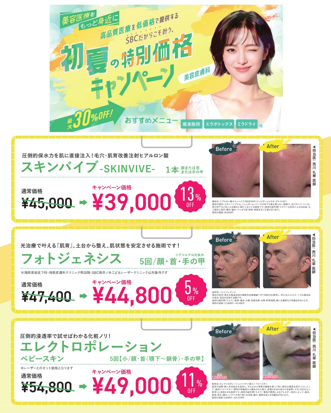 5月キャンペーン