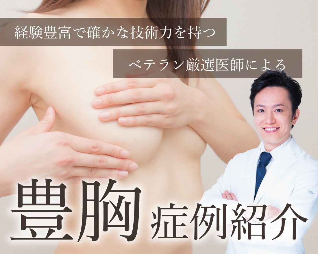 【豊胸の名医】横浜で豊胸するなら横浜東口院！経験豊富なプレミアムドクター加藤医師の豊胸症例をご紹介！