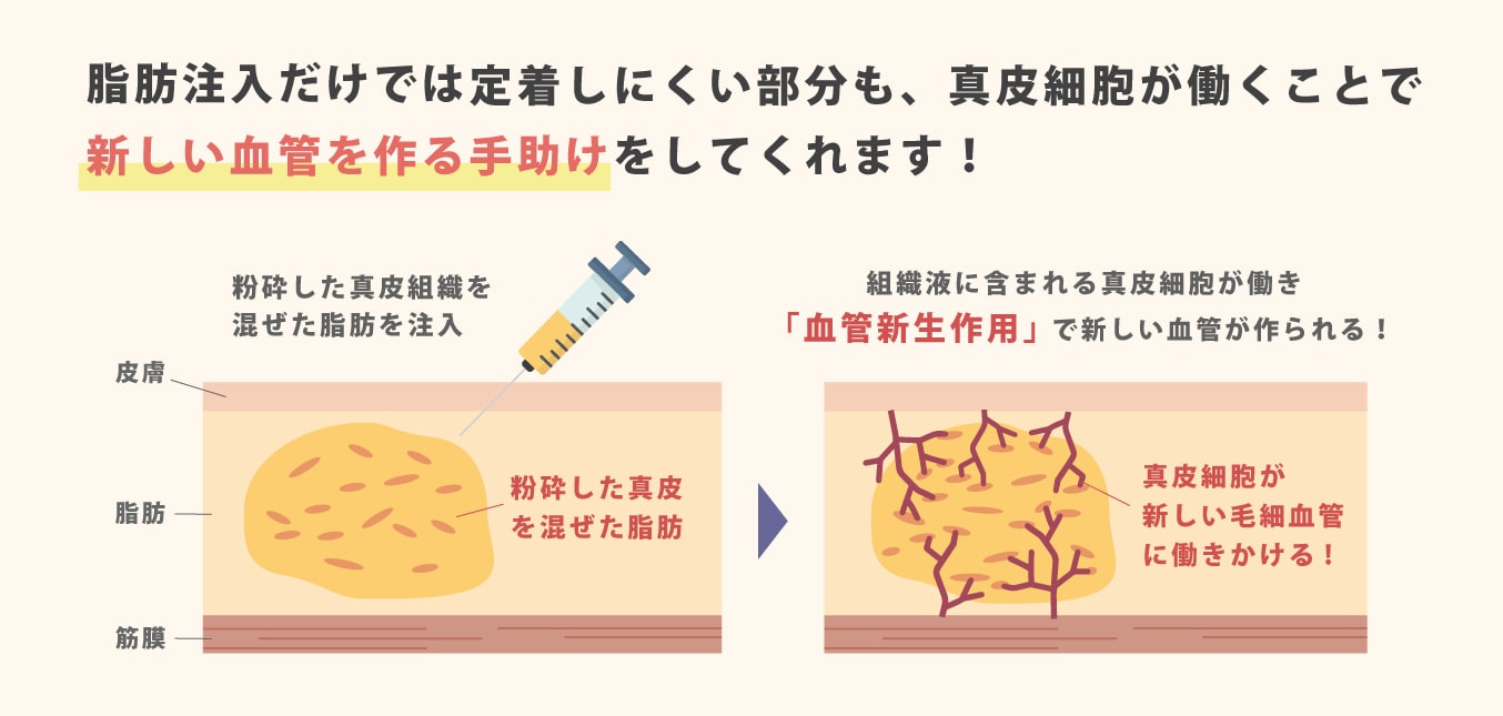 「血管新生作用」で定着率UP！