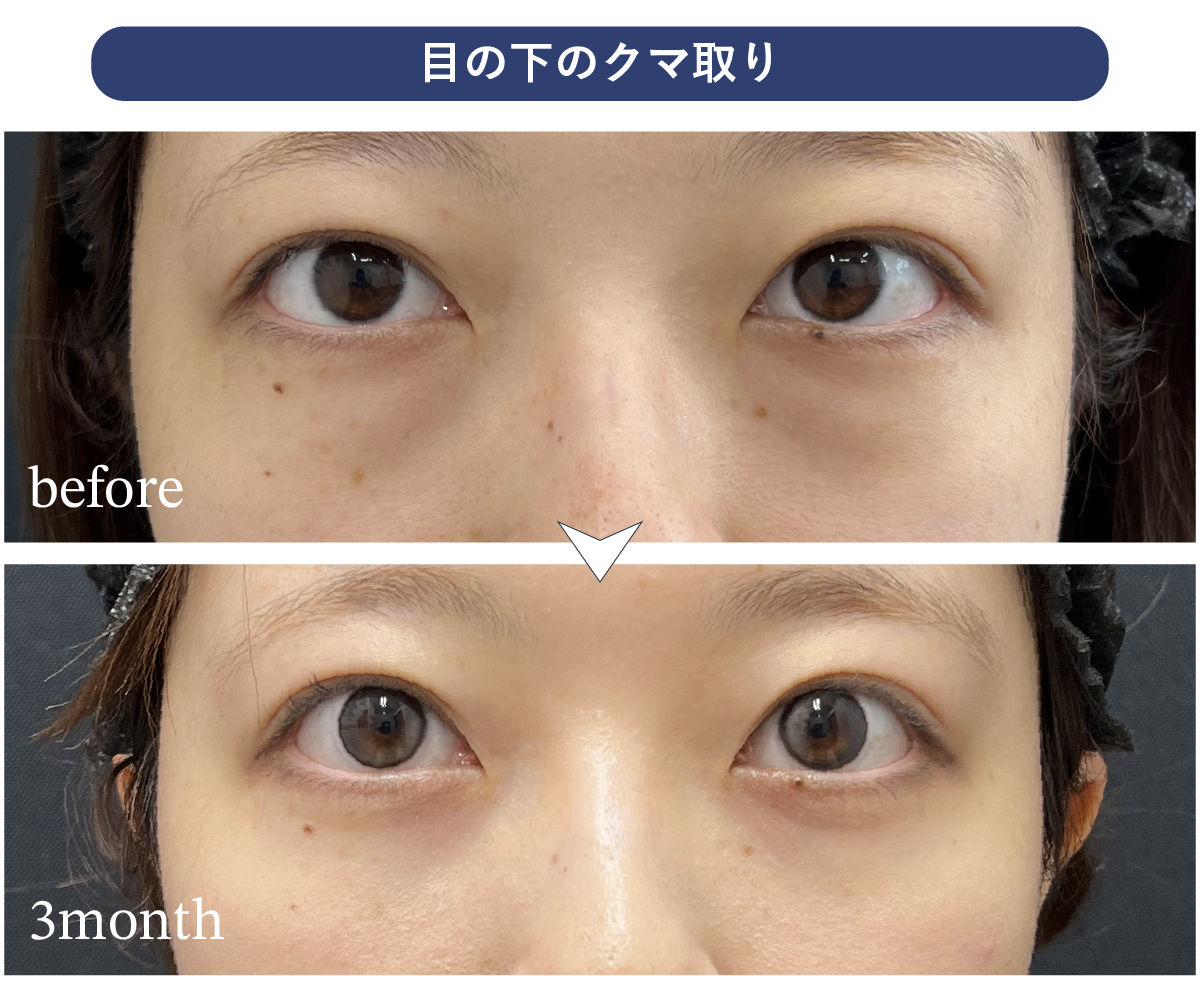 20代女性の症例