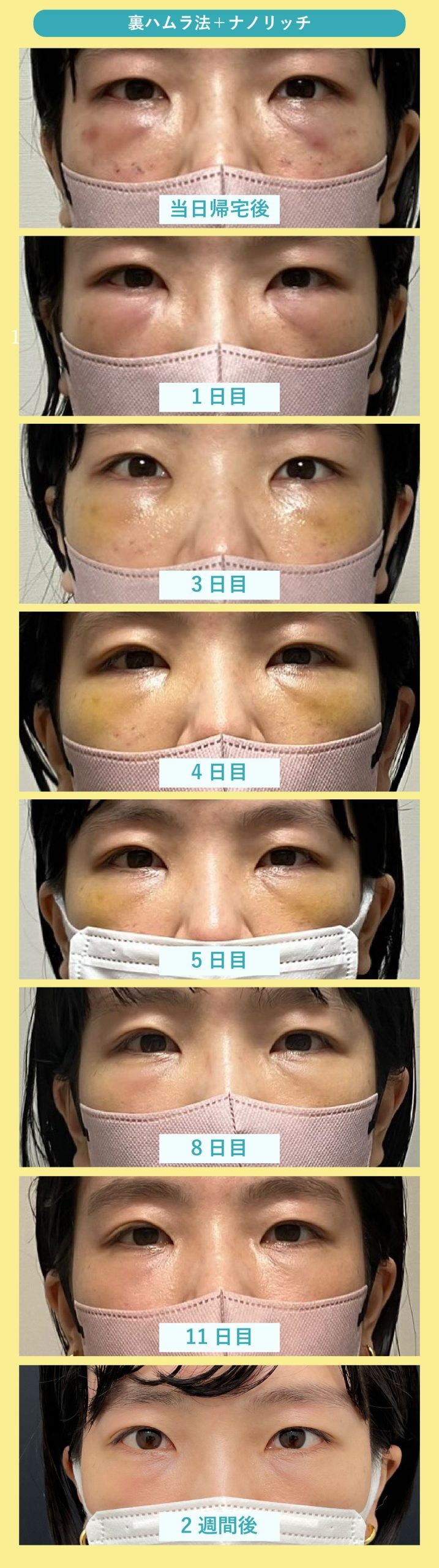 30代女性の症例