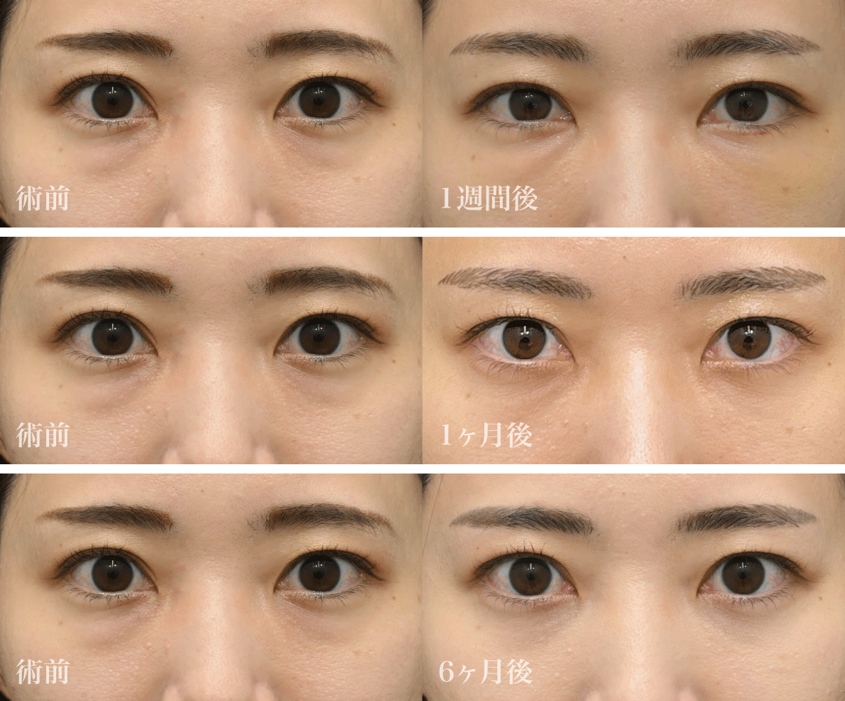 まずは美しすぎる<br />
Before／After