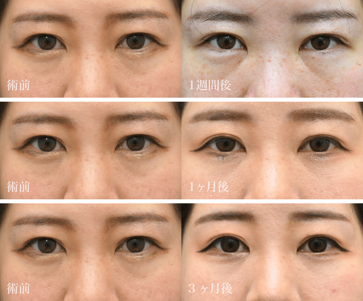 まずは美しすぎる<br />
Before／After