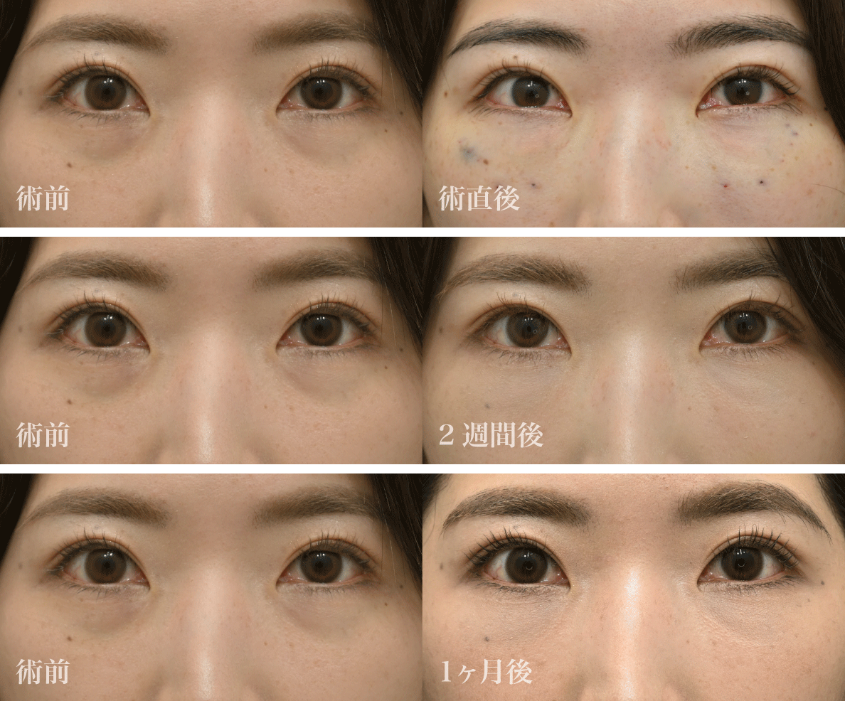 まずは美しすぎる<br />
Before／After