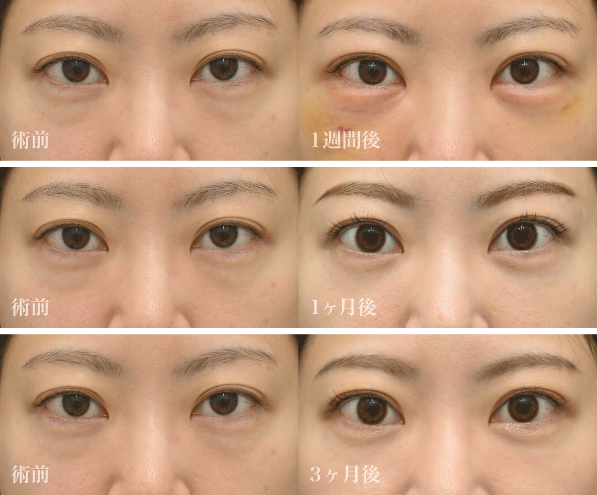 まずは美しすぎる<br />
Before／After