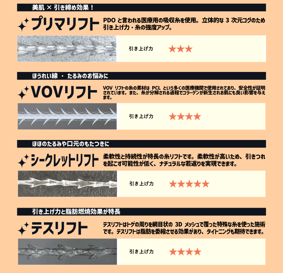糸の種類