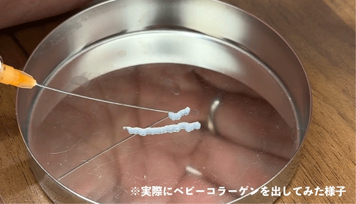 手術なしで目の下の<br />
小ジワや凹み、色味改善