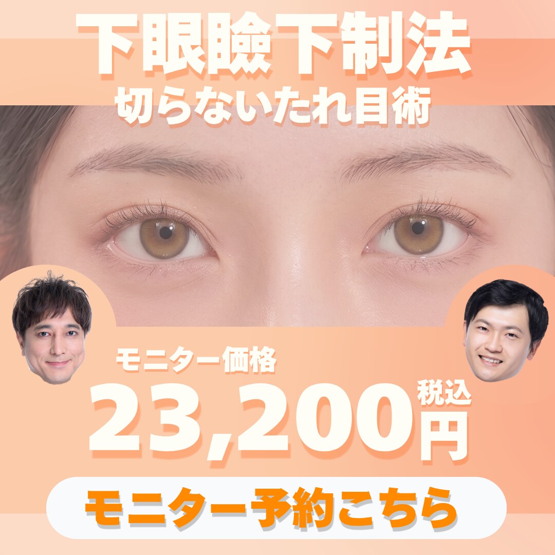 下眼瞼下制法(切らないたれ目術)モニターご予約はこちら