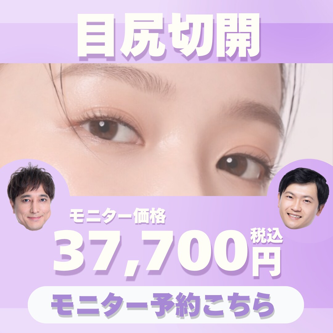 目尻切開モニターご予約はこちら