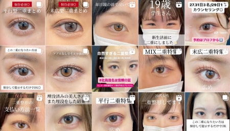 圧倒的な症例数