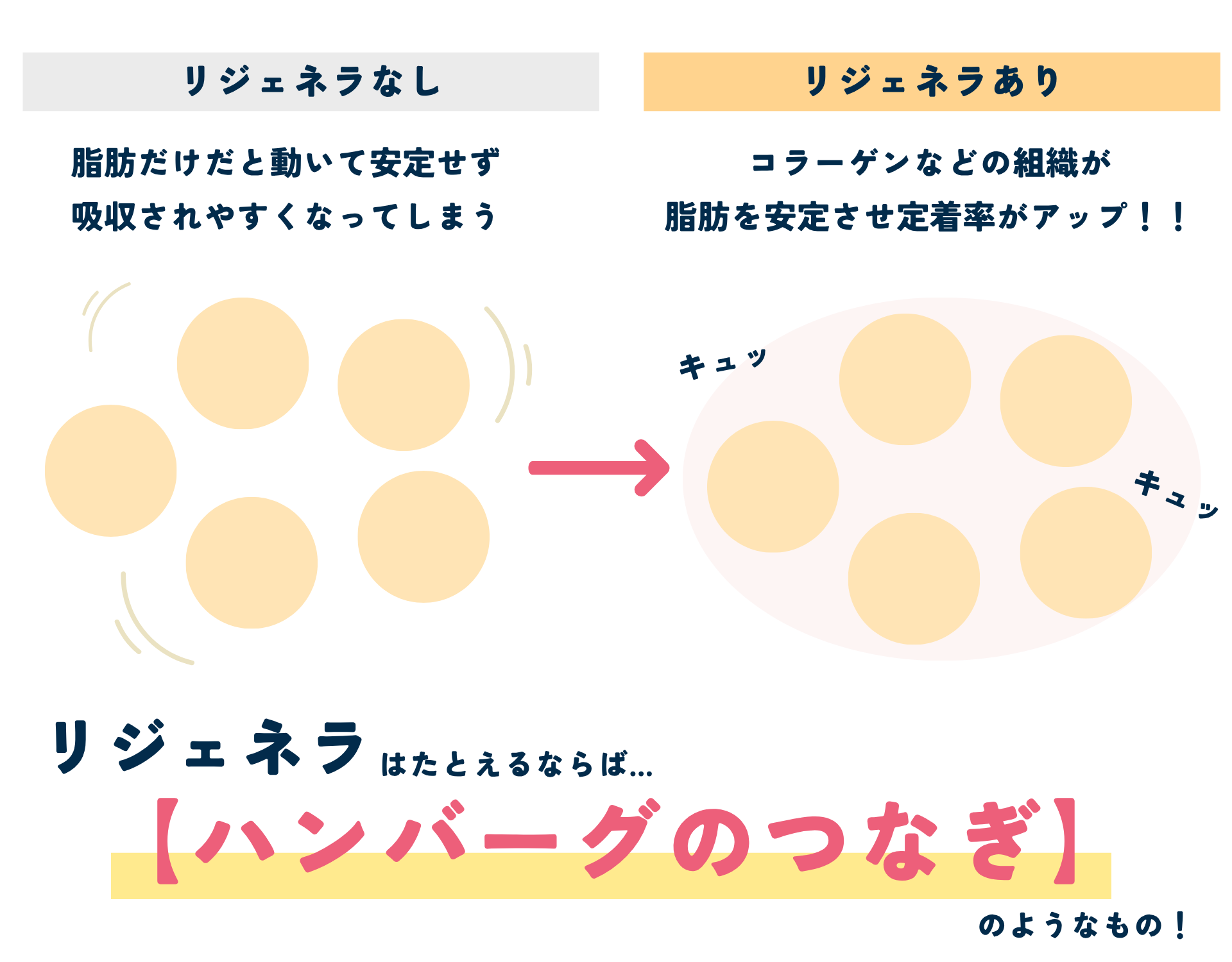 例えるなら...？