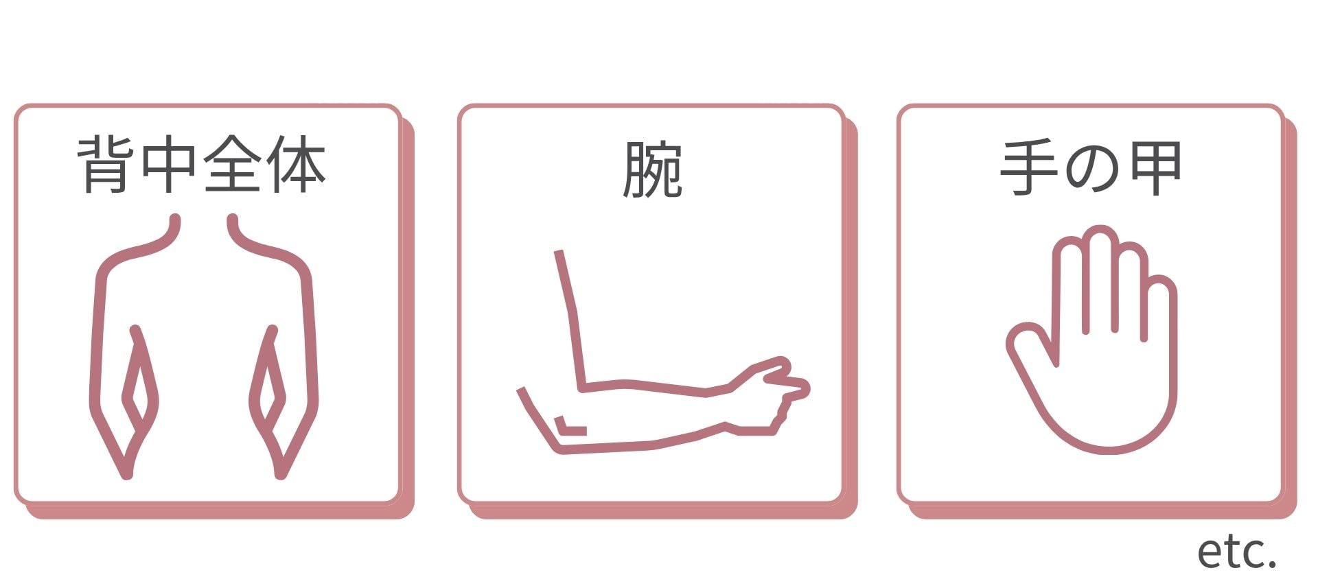 気になる“あの部分”もOK？対象部位をチェック✨