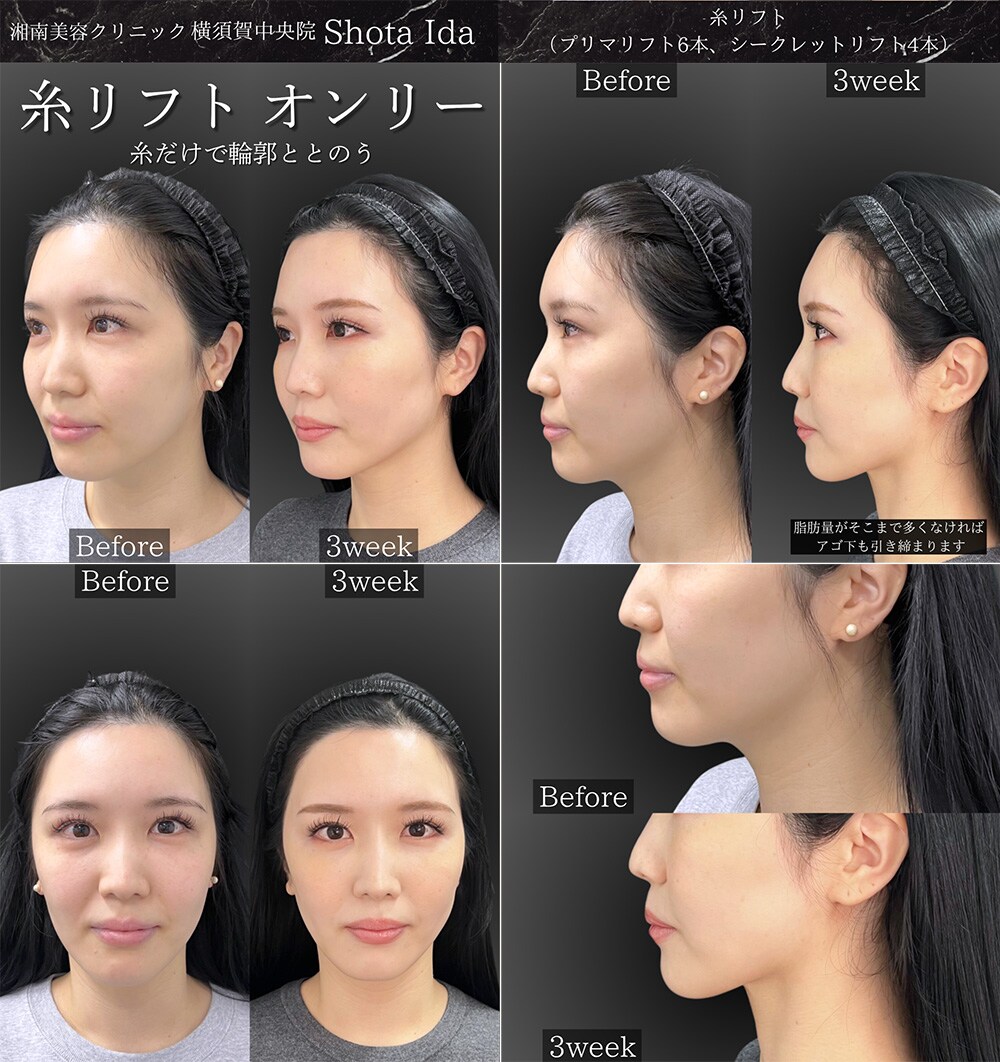 360度 どこから見ても美しい仕上がり