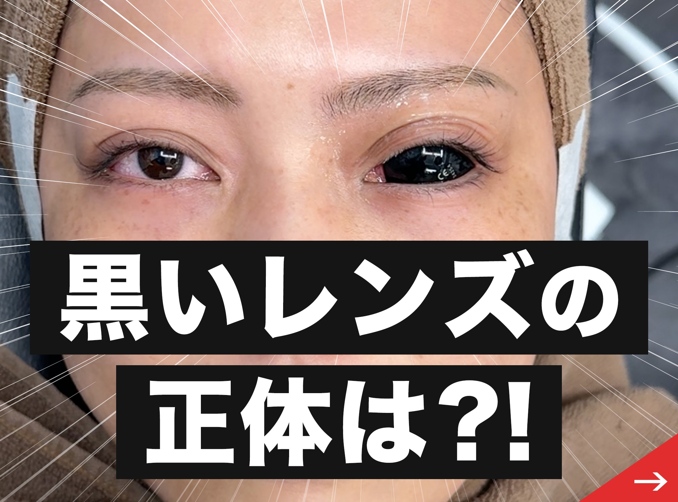 何これ？黒いレンズの正体は…？！横須賀中央院でデンシティが爆売れしている理由