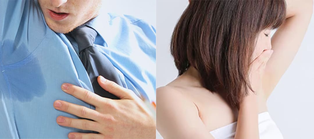 なぜ、その「ワキ汗」は止まらないのか？