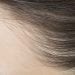生まれつきの薄毛にお悩みの女性に。薄毛治療と悪化させないためにできること