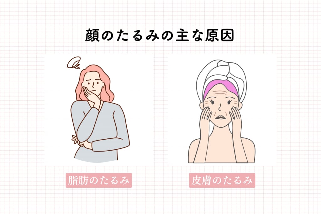 顔のたるみの主な原因＿インフォグラフィック