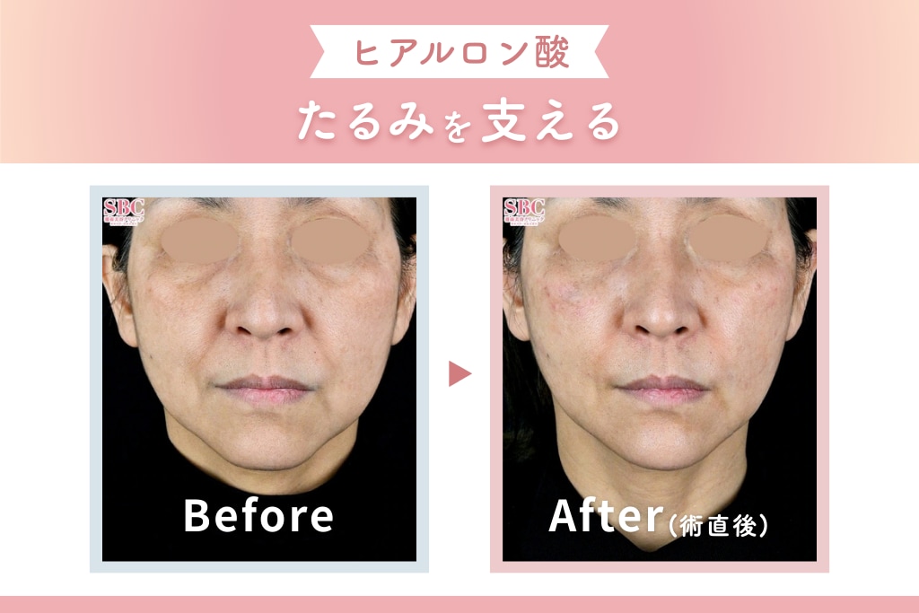 サンプル症例