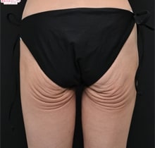 症例写真