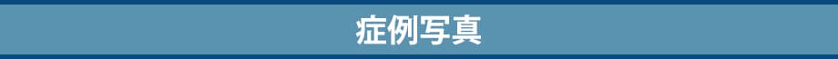 症例写真