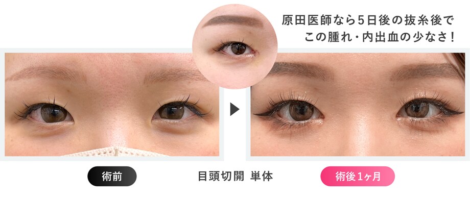症例写真
