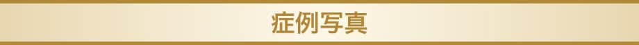 料金下症例写真