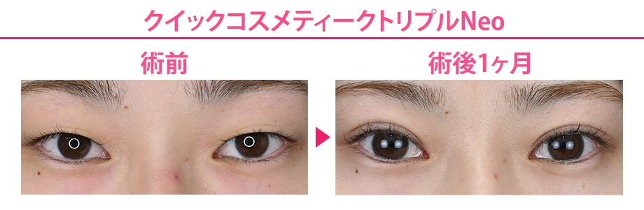 before-after