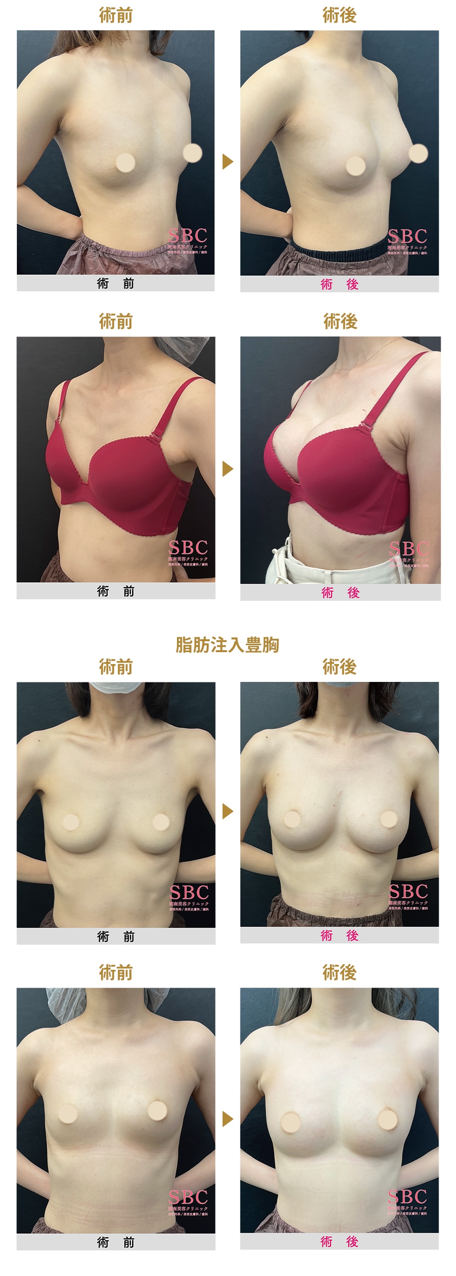 料金下症例写真