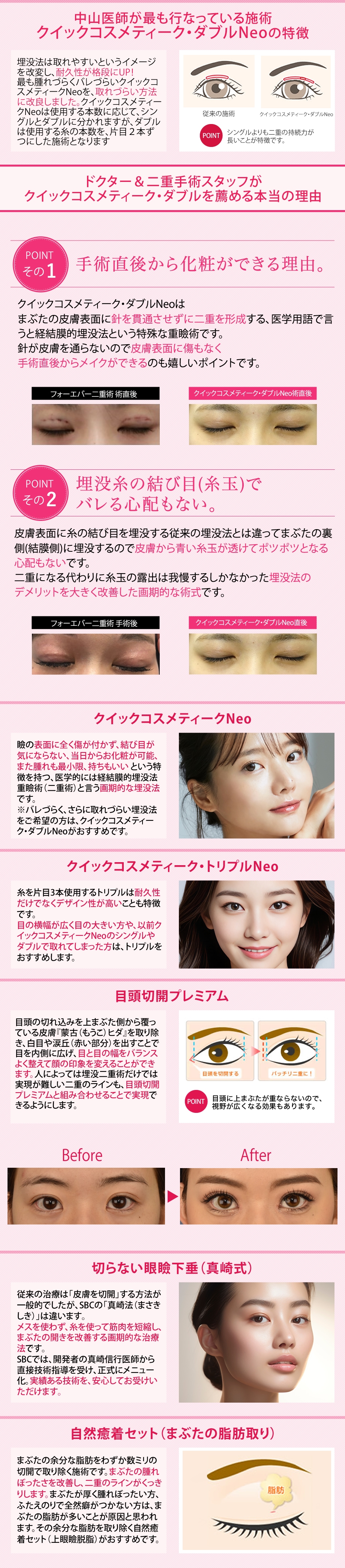 施術解説小カテ