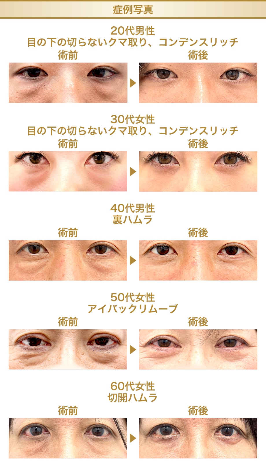 料金下症例写真