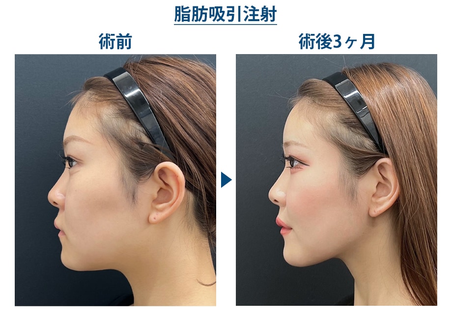 ピックアップ症例写真