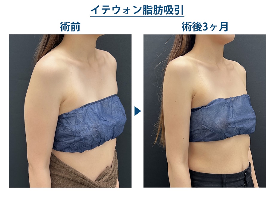 ピックアップ症例写真